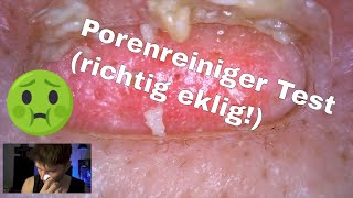 Mitesser Sauger  Entferner  Porenreiniger Test als MANN  Richtig Satisfying To Watch [upl. by Sihtam]