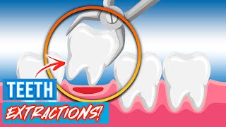 Tooth Extractions For Braces  Why Do Orthodontists Extract Teeth [upl. by Ignacius]