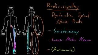 Syndrome Radiculopathy [upl. by Akinahc299]