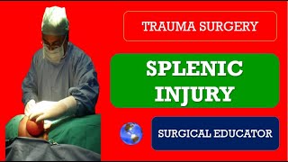 SPLENIC INJURY  How to DIAGNOSE amp TREATBlunt Injury Abdomen  Trauma Surgery [upl. by Rochester240]