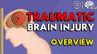 Overview of Traumatic Brain Injury TBI [upl. by Bibah]