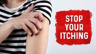 What Causes Hives and Itchiness  Urticaria Hives Treatment  Dr Berg [upl. by Nobell723]