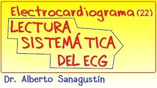 Electrocardiograma 22 LECTURA del ECGEKG e interpretación [upl. by Euqinomad]