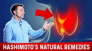 Thyroiditis Symptoms Explained  ALL Types  Causes amp What to Expect [upl. by Carpenter]