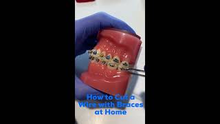 How to Cut an Orthodontic Wire at Home  David Ross Orthodontics [upl. by Tannenwald998]