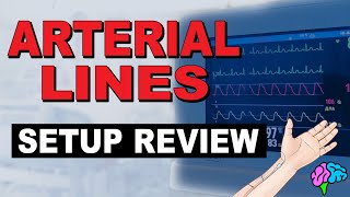 The Arterial Line Setup REVIEWED [upl. by Maddalena]