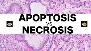 Apoptosis Intrinsic Extrinsic Pathways vs Necrosis [upl. by Akemrehs]