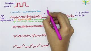 Understanding the EEG [upl. by Peednas583]