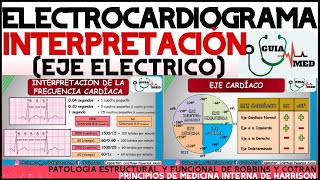 ELECTROCARDIOGRAMA INTERPRETACIÓN  GuiaMed [upl. by Werd]