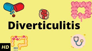 Diverticulitis Signs amp Symptoms And Why They Occur [upl. by Jourdain]