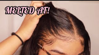 How to RE Install Frontal Wigs for Beginners  VERY DETAILED  Melt Transparent Lace [upl. by Anelliw253]