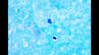 Mycobacterium under microscope afb positive [upl. by Noby186]