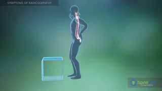 Radiculopathy Symptoms [upl. by Boniface]