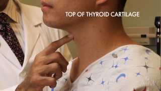 The Thyroid Exam Stanford Medicine 25 [upl. by Ahtnama]