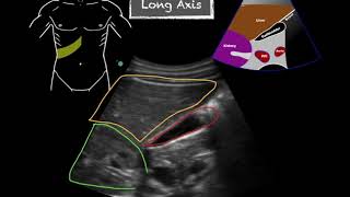 POCUS  Gallbladder Ultrasound Anatomy [upl. by Frederich]