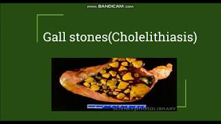 Cholelithiasis  Gallstones Pathogenesis amp Morphology [upl. by Rivera588]