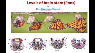 practical brain stem levels pons [upl. by Eul]