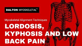 Lordosis Kyphosis and Low Back Pain [upl. by Akinet342]