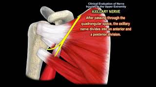 NERVE INJURY IN THE UPPER EXTREMITY Everything You Need To Know  Dr Nabil Ebraheim [upl. by Cathrin]