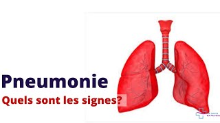 PNEUMONIE QUELS SONT LES SYMPTÔMES D´ALERTE [upl. by Aciamaj]