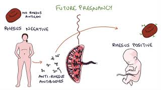 Antenatal Breathing and Relaxation for Labour [upl. by Eceinal327]