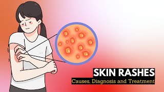 Skin Rash Causes Signs and Symptoms Diagnosis and Treatment [upl. by Penhall]