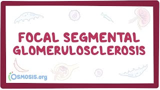 Focal Segmental Glomerulosclerosis  causes symptoms diagnosis treatment pathology [upl. by Notnil365]