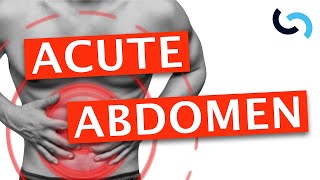 Acute Abdomen  Diagnosis and Management [upl. by Hutner]