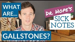 What are gallbladder stones [upl. by Alphonse]