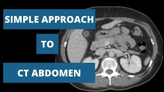 How to read a CT Abdomen  Part 2 [upl. by Marte]