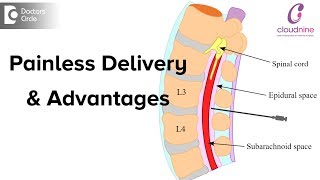 What is Painless Delivery Is epidural given during normal deliveryDrVanita Mande of C9 Hospitals [upl. by Rudolfo]