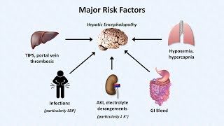 Hepatic Encephalopathy [upl. by Akiram]