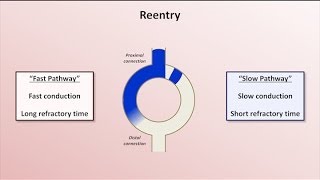 Intro to EKG Interpretation  Mechanisms of Tachyarrhythmias [upl. by Tterraj]