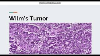 Wilms Tumor [upl. by Rexanna876]