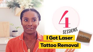 Amazing Laser Tattoo Removal Results [upl. by Schaeffer632]