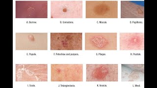 Skin Lesions with defination [upl. by Junette85]