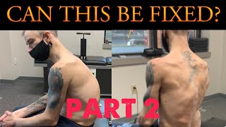 20 mins Posture Routine for Kyphosis Rounded Upper Spine [upl. by Maighdiln988]