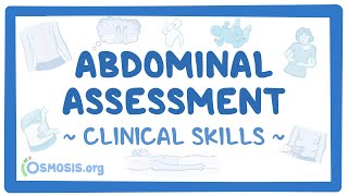 Abdominal Assessment Clinical Skills [upl. by Els]