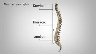 Radiculopathy  Patient Education [upl. by Akilegna243]