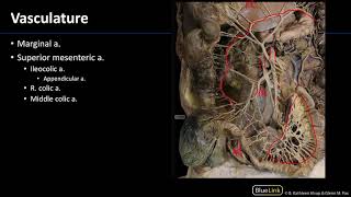 Transcatheter Aortic Valve Implantation TAVI [upl. by Adnalra]