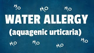 Water Allergy 10 Interesting Facts About Aquagenic Urticaria [upl. by Trebo211]