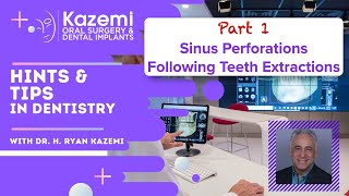 Part 1 Sinus Perforations Following Teeth Extractions [upl. by Akyeluz581]