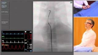 Catheterisation Left and Right Coronary Arteries [upl. by Rob]